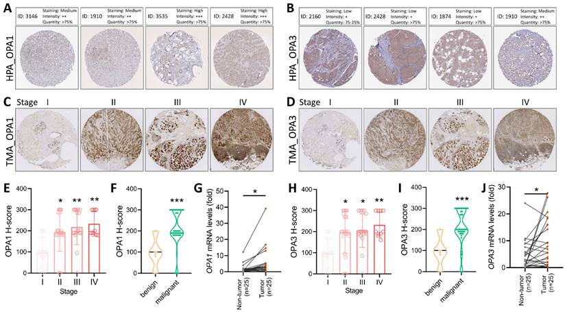 J Cancer Image