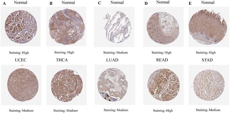 J Cancer Image