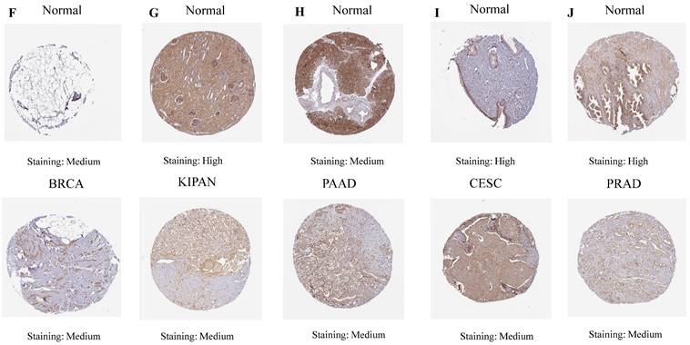J Cancer Image