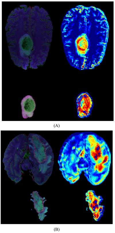 J Cancer Image