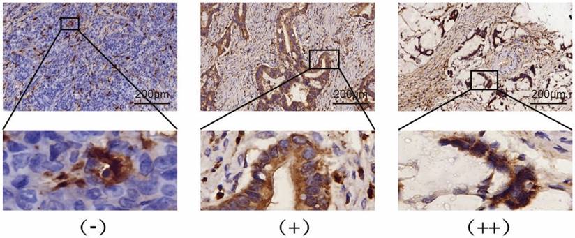 J Cancer Image