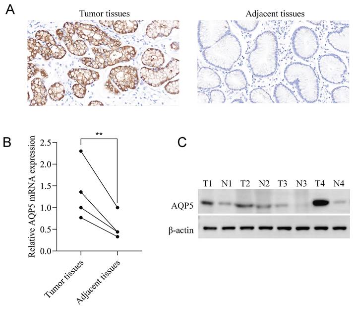 J Cancer Image