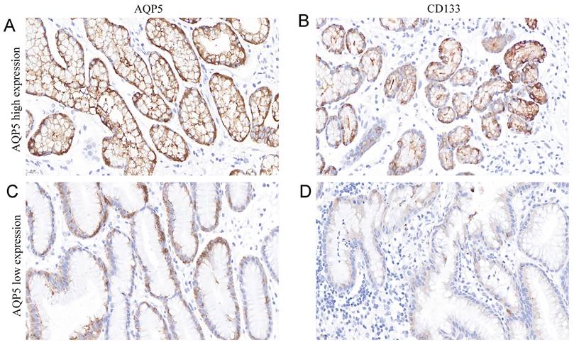 J Cancer Image
