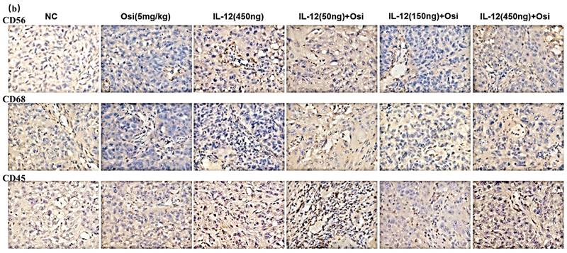 J Cancer Image