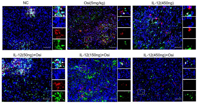 J Cancer Image