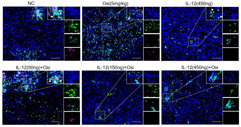 J Cancer Image