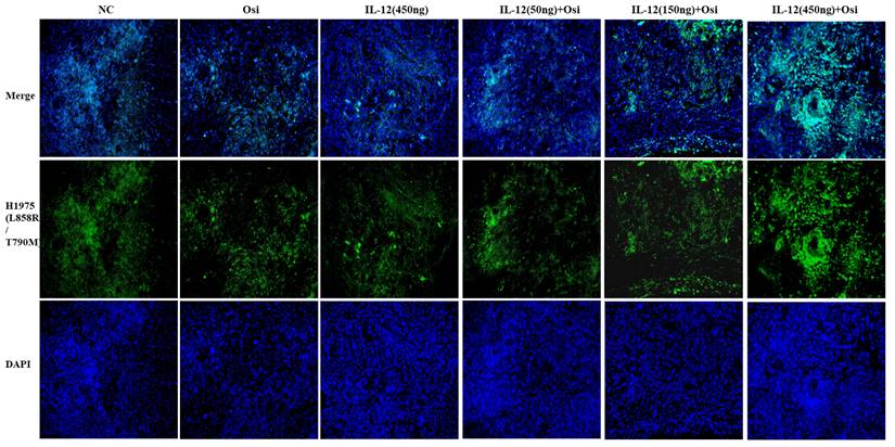 J Cancer Image