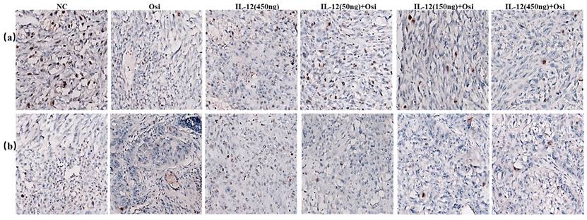 J Cancer Image