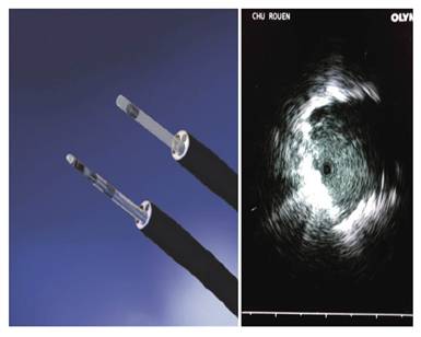 J Cancer Image