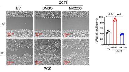 J Cancer Image