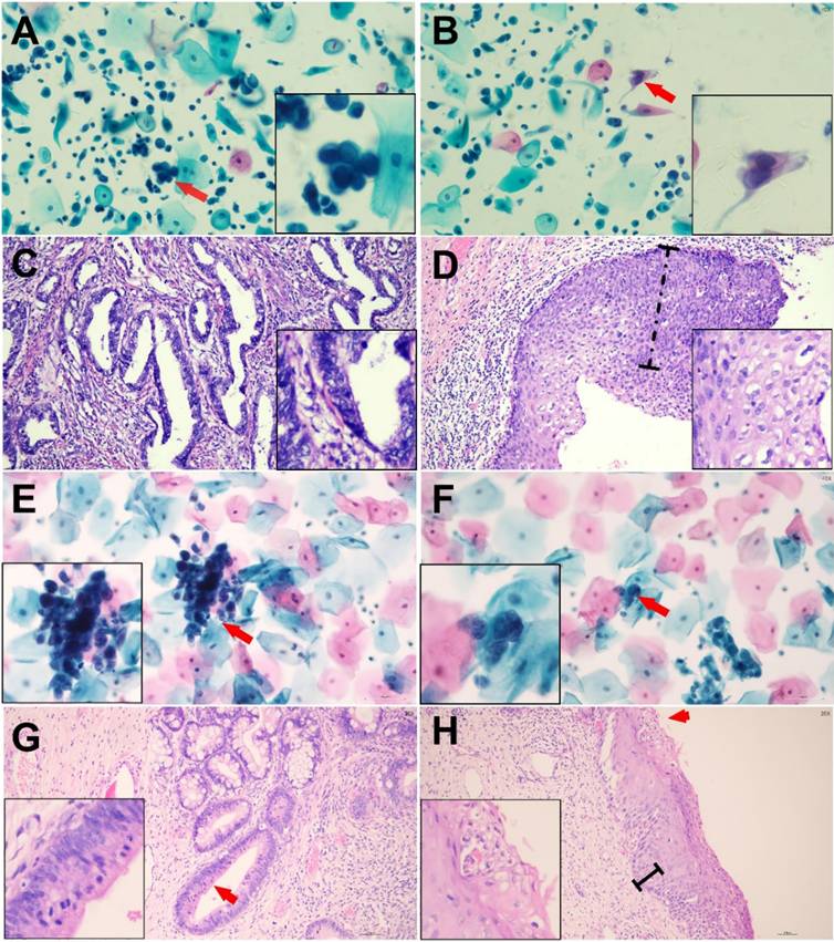 J Cancer Image