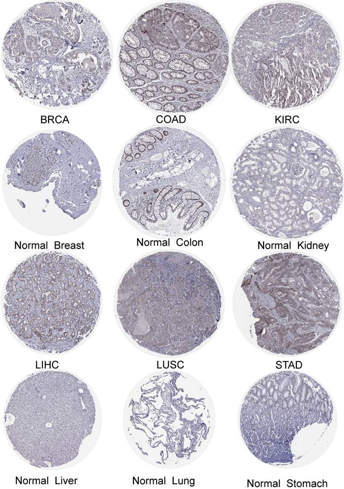 J Cancer Image