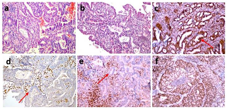J Cancer Image