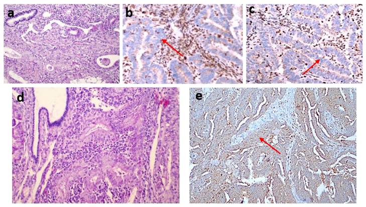 J Cancer Image