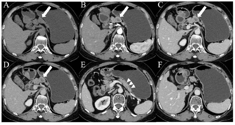 J Cancer Image