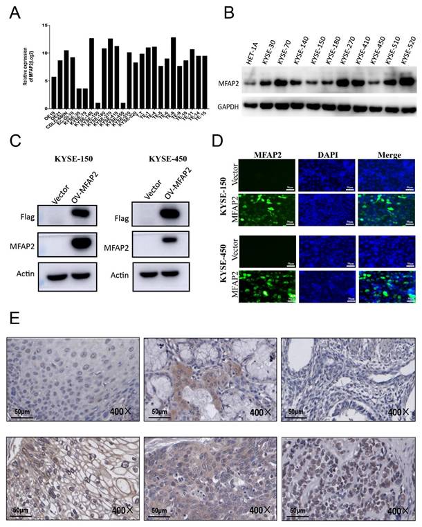 J Cancer Image