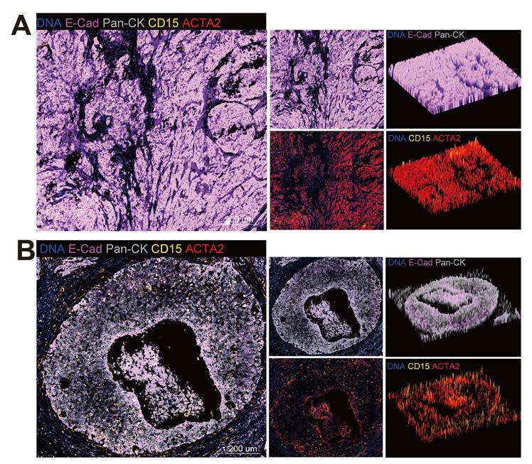 J Cancer Image
