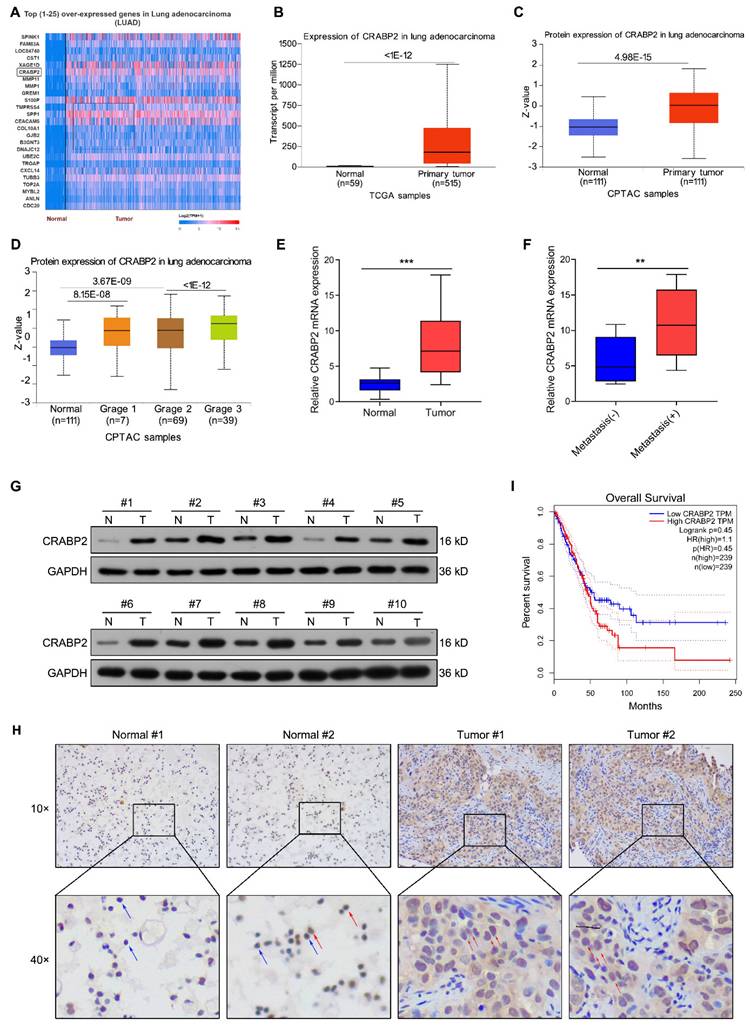 J Cancer Image