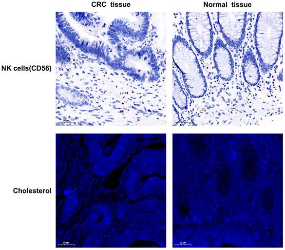 J Cancer Image