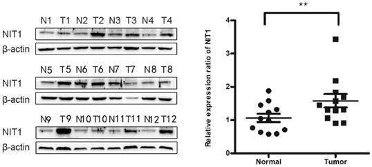 J Cancer Image