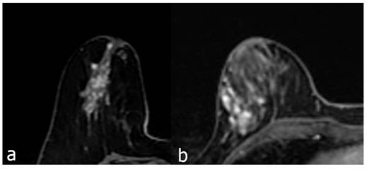 J Cancer Image