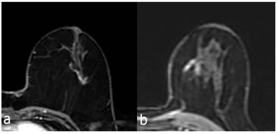 J Cancer Image