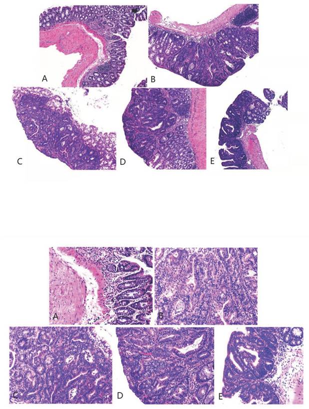 J Cancer Image