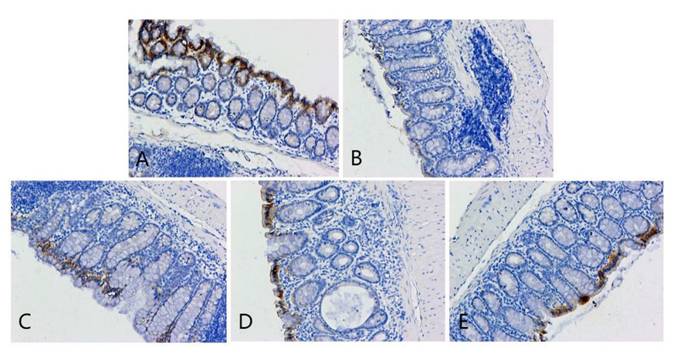 J Cancer Image