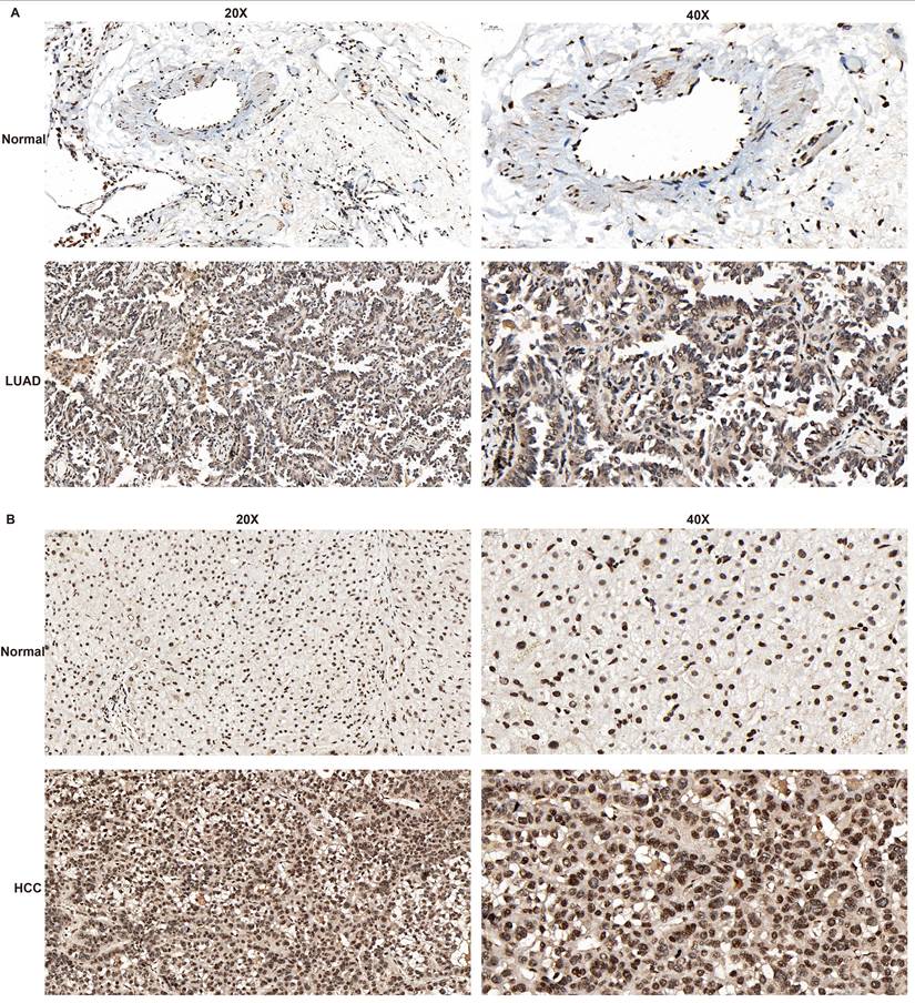 J Cancer Image
