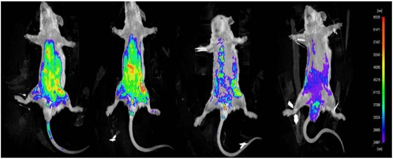 J Cancer Image