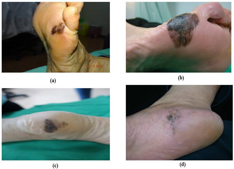 J Cancer Image