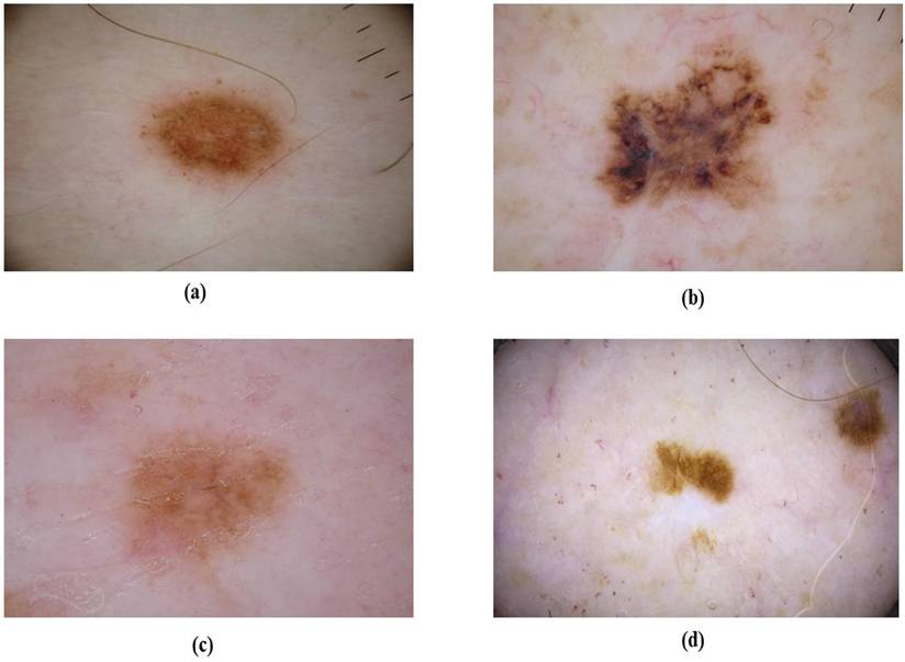 J Cancer Image