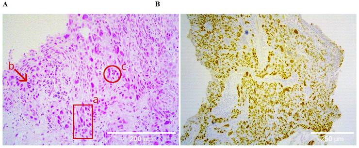 J Cancer Image