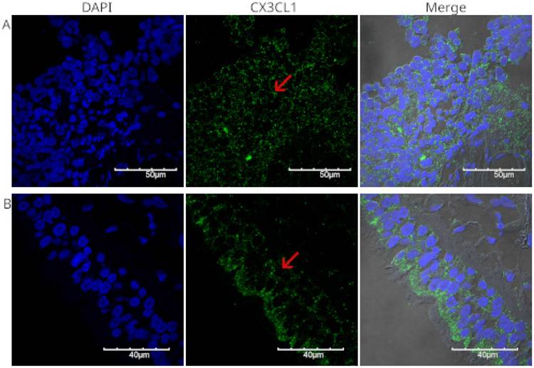J Cancer Image