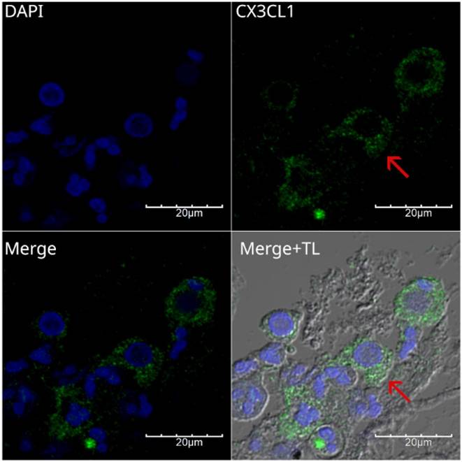 J Cancer Image