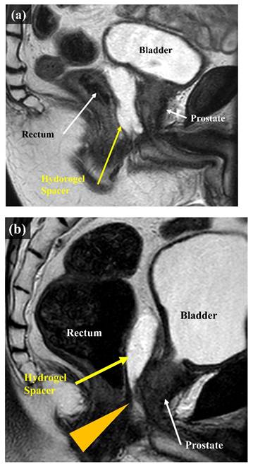 J Cancer Image