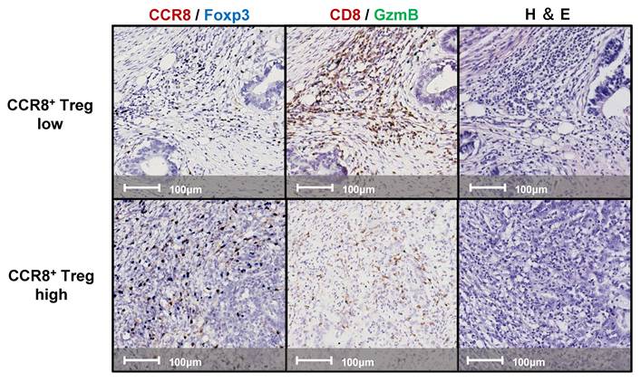 J Cancer Image