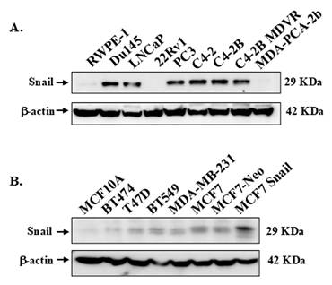 J Cancer Image