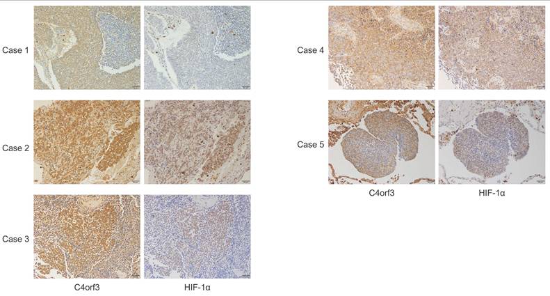 J Cancer Image