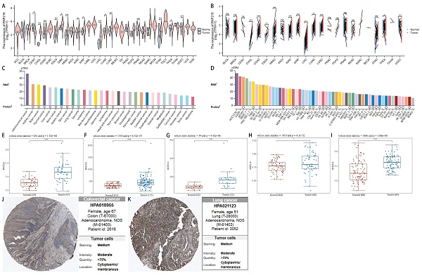 RNF216 as a Promising Biomarker for Prognosis, Immunotherapy, and