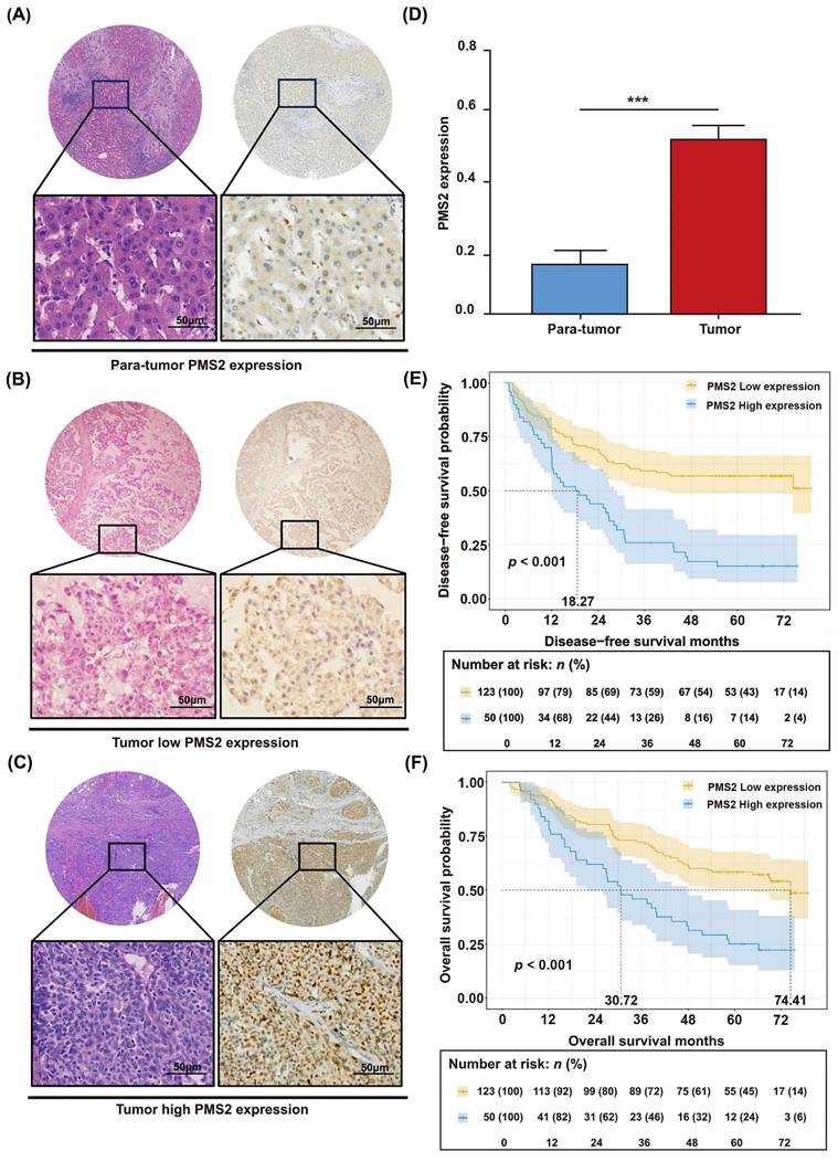 J Cancer Image