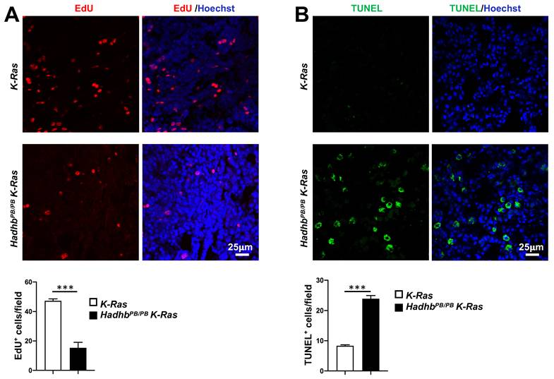 J Cancer Image