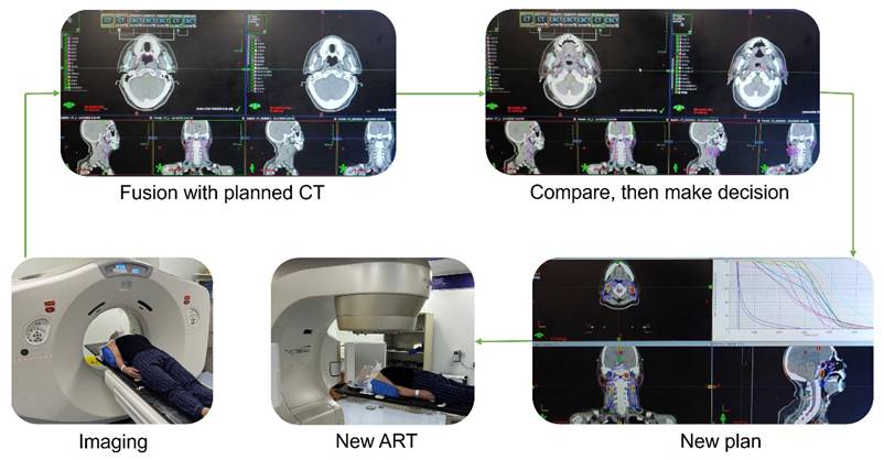 J Cancer Image