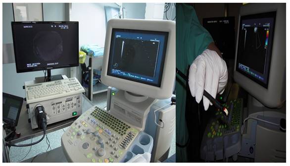 J Cancer Image
