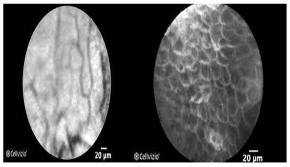 J Cancer Image