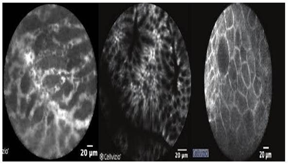 J Cancer Image