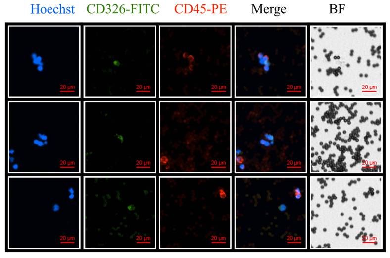 J Cancer Image