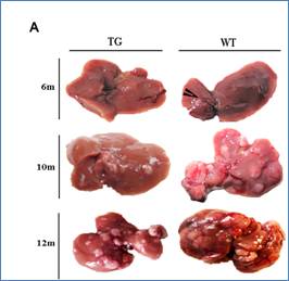 J Cancer Image