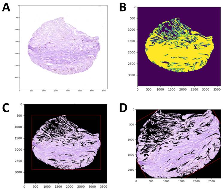 J Cancer Image