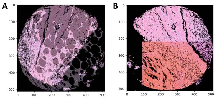 J Cancer Image